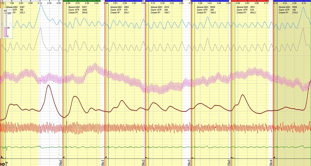САТ на имя 1