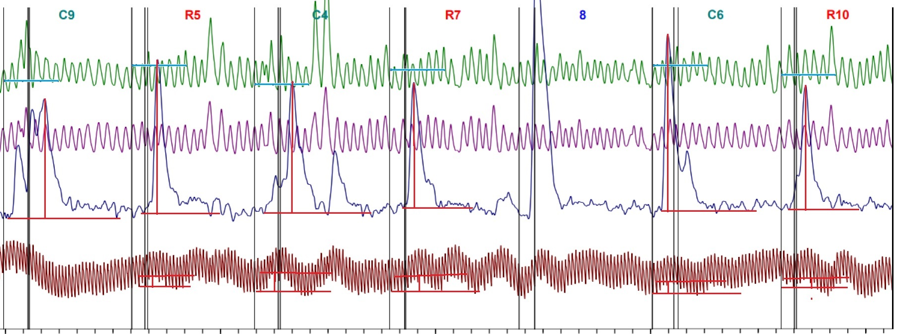 Предъявление 3
